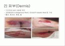 간호사 창상관리 컨퍼런스 6페이지