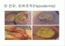 간호사 창상관리 컨퍼런스 7페이지