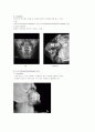 X-ray에 대해 3페이지