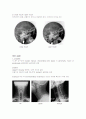 X-ray에 대해 4페이지