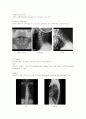 X-ray에 대해 5페이지