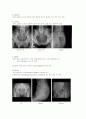X-ray에 대해 7페이지