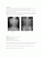 X-ray에 대해 9페이지