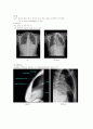 X-ray에 대해 13페이지