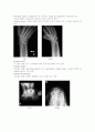 X-ray에 대해 16페이지