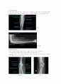 X-ray에 대해 17페이지