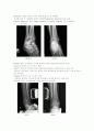 X-ray에 대해 21페이지