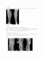 X-ray에 대해 22페이지