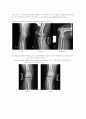 X-ray에 대해 23페이지