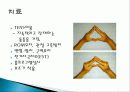 Brachial plexus injury(상완신경총 손상) 16페이지