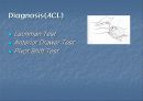 십자인대손상의 재활 15페이지