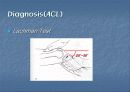 십자인대손상의 재활 16페이지