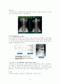 척추관 협착증(Spinal Stenosis)case study 6페이지