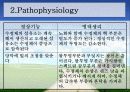 백내장 원인과 종류, 수술후 간호  3페이지