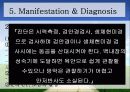 백내장 원인과 종류, 수술후 간호  9페이지
