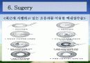 백내장 원인과 종류, 수술후 간호  12페이지