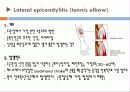   elbow joint disorser  13페이지