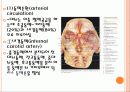 뇌졸중(Stroke) 8페이지