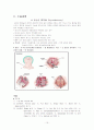 갑상선절제술, thyroidectomy 16페이지