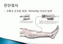 (성인) 구획증후군 Compartment Syndrome 사례연구 3페이지