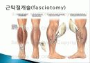 (성인) 구획증후군 Compartment Syndrome 사례연구 4페이지