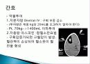 (성인) 구획증후군 Compartment Syndrome 사례연구 8페이지