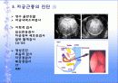 자궁근종 case  9페이지