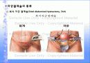 자궁근종 case  14페이지