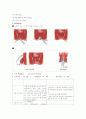 CASE STUDY(치핵절제술) 6페이지