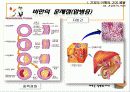 건강의 적 비만 예방 교육 16페이지