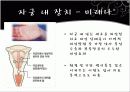 피임의 방법 15페이지