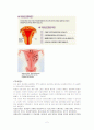산부인과 병동 자궁선근종 case 2페이지