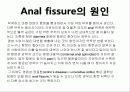 Anal fissure (치열) 4페이지