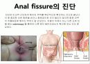 Anal fissure (치열) 5페이지