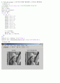 영상신호처리 중간고사 레포트(히스토그램 평활화, 이동평균필터링, Salt and pepper노이즈 제거, 줄무늬 노이즈 제거) 3페이지