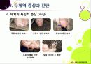 [구제역]구제역 이해의 모든 것 - 구제역의 개념 및 원인체, 전염경로, 증상, 진단, 발생 사례, 예방 및 대처법 등 설명 12페이지