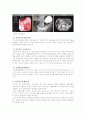 위암 (Gastric Ca 케이스) 4페이지