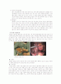 위암 (Gastric Ca 케이스) 8페이지