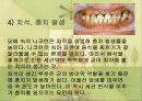 흡연이 구강건강에 미치는 영향 6페이지