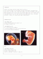 [간호학]유산(abortion) 3페이지