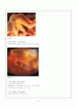[간호학]유산(abortion) 6페이지