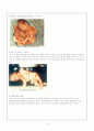 [간호학]유산(abortion) 9페이지