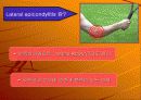 tennis elbow(외측상과염) 3페이지