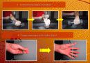 tennis elbow(외측상과염) 15페이지