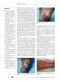 Telemedicine in wound care 1페이지