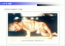 [간호학]abortion 간호학개론 17페이지