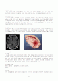 SDH&EDH에 관한 질병 고찰 및 case study(SICU) 6페이지