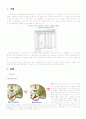 cerabral infarction(뇌경색) 케이스 3페이지