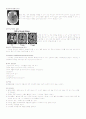 cerabral infarction(뇌경색) 케이스 6페이지