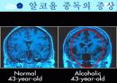 알코올 중독 예방교육 7페이지